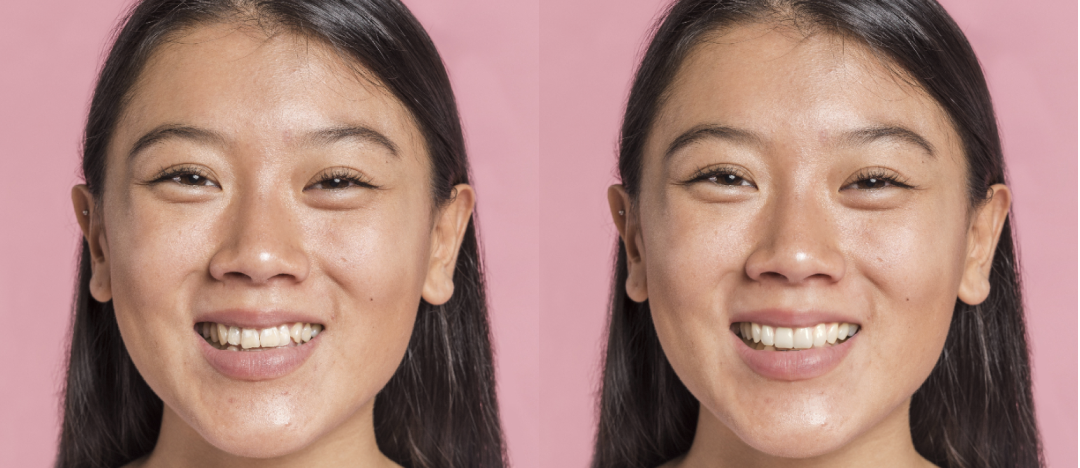 Orthodontics — example