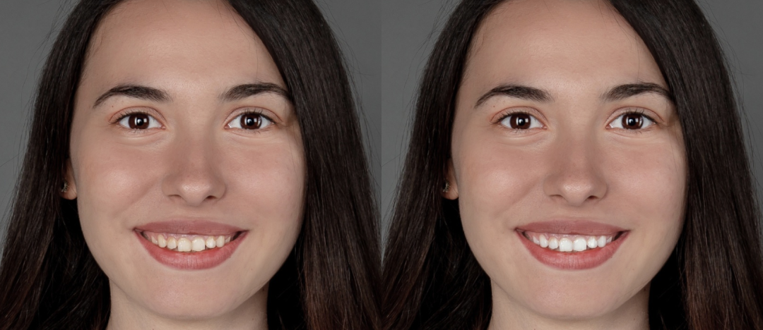 Whitening — example