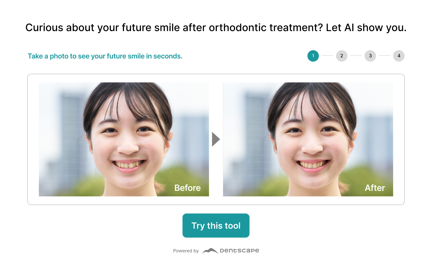 Dentscape smile simulation widget embedded on a WordPress page — before/after orthodontic preview