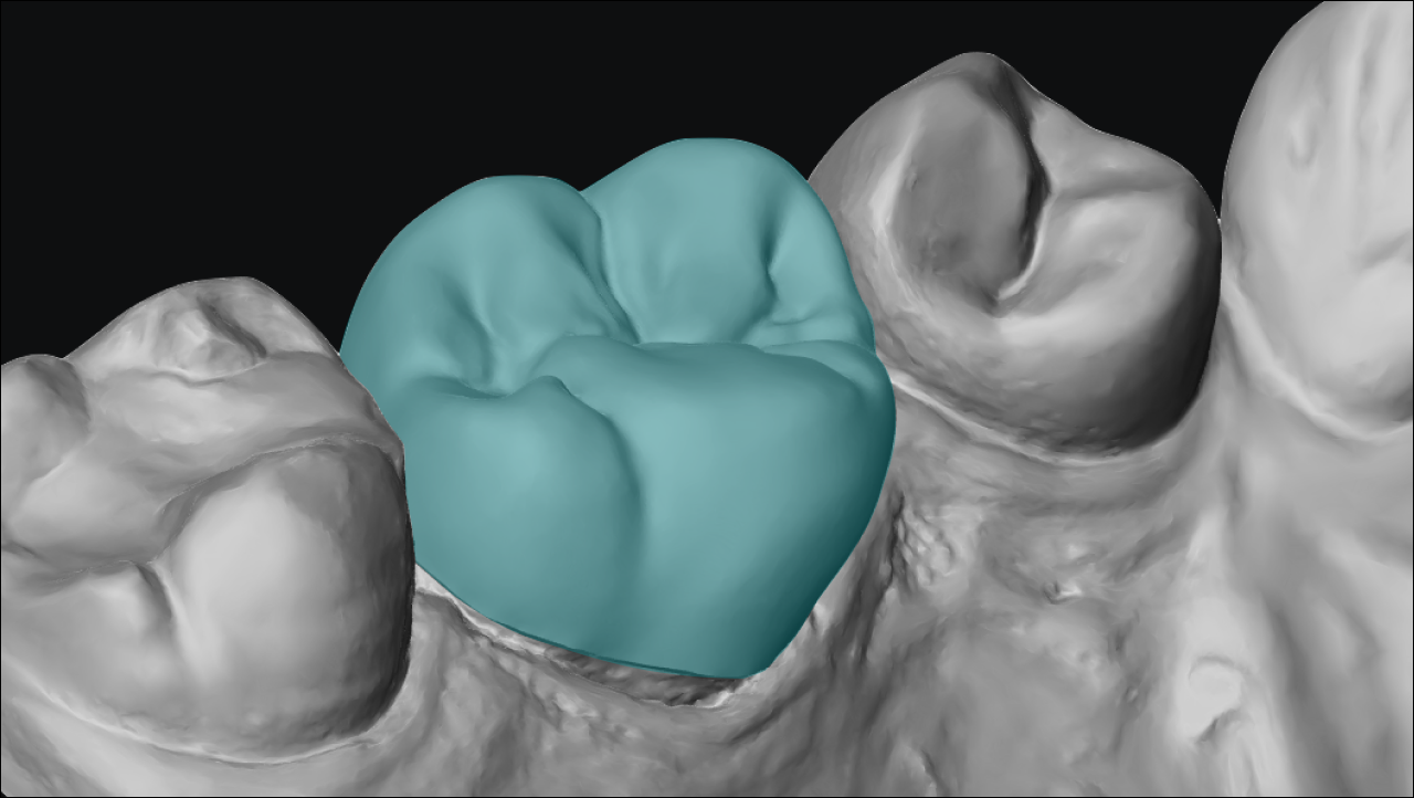 Supported indications — single and multiple units, anterior and posterior crowns, and 3-unit bridges