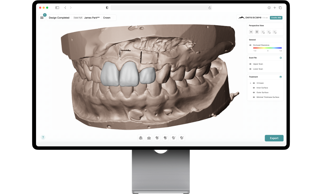 AI crown design — occlusal morphology refined frame by frame