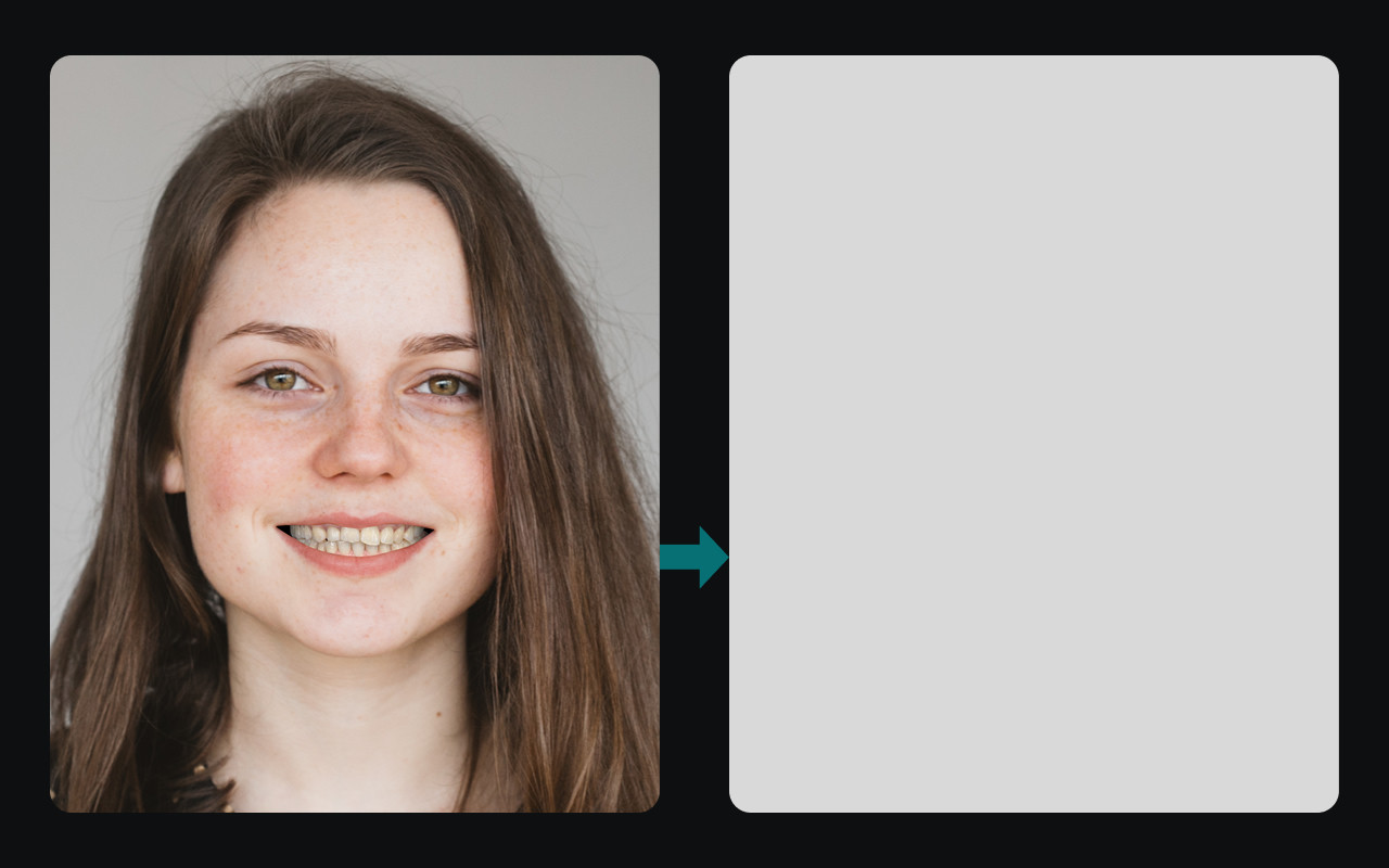 A patient photo transformed into an AI smile simulation preview