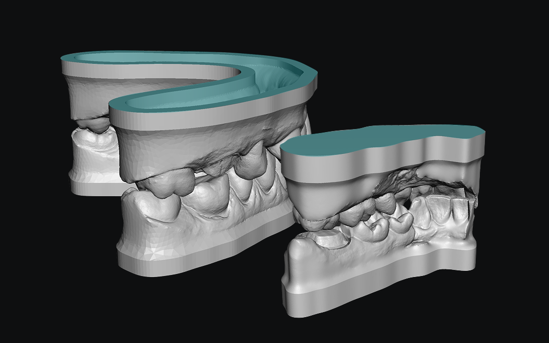 Working models — full arch and contact models with solid or hollow base