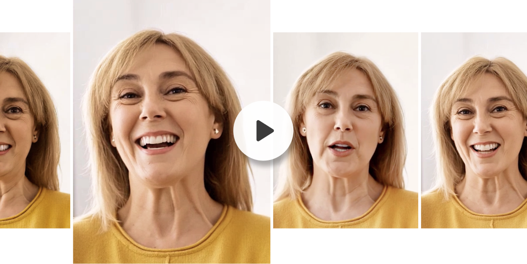 Talking video smile simulation — patient speaking and smiling with her new smile design in motion