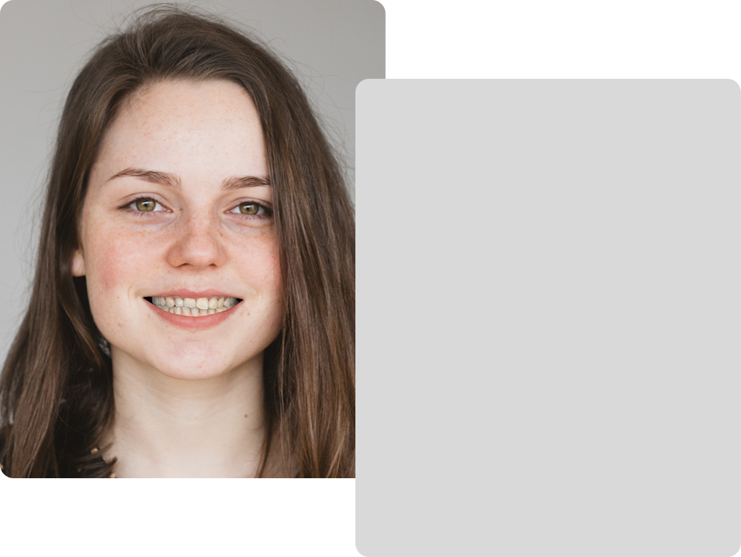 Patient portrait next to her AI smile simulation