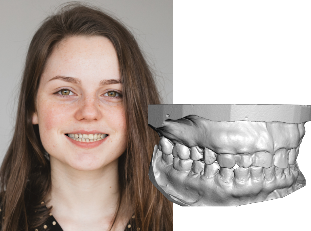 Patient portrait photo next to the raw 3D intraoral scan, ready for upload