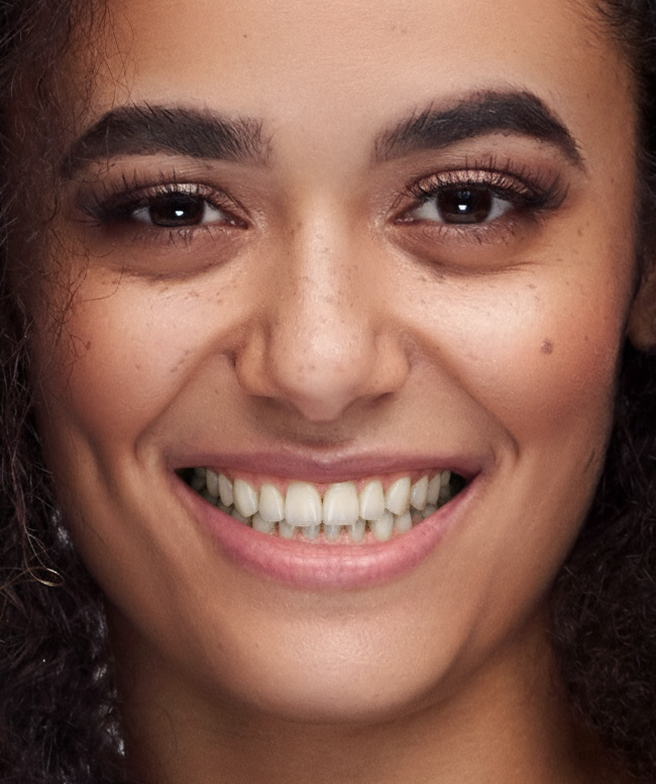Smile Rendering — simulation image