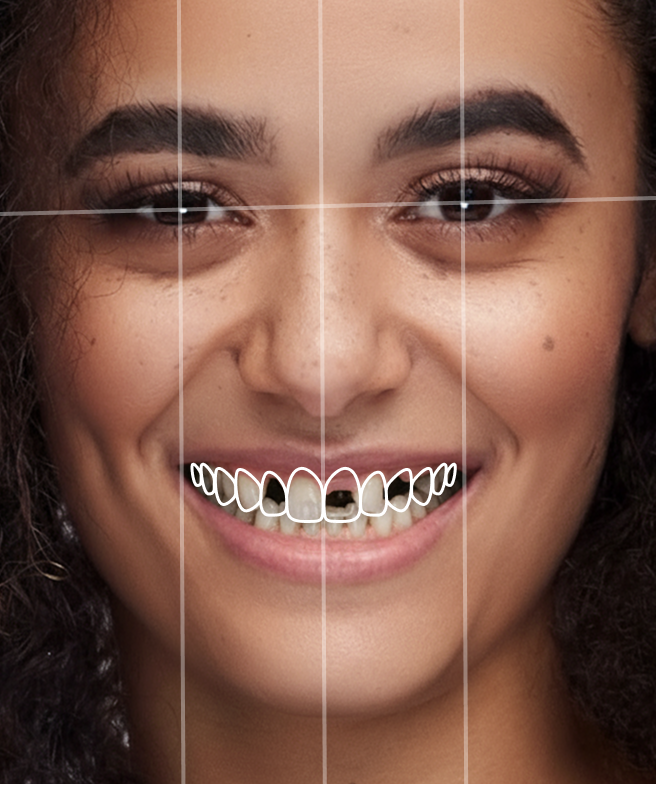 Smile Artist — initial
