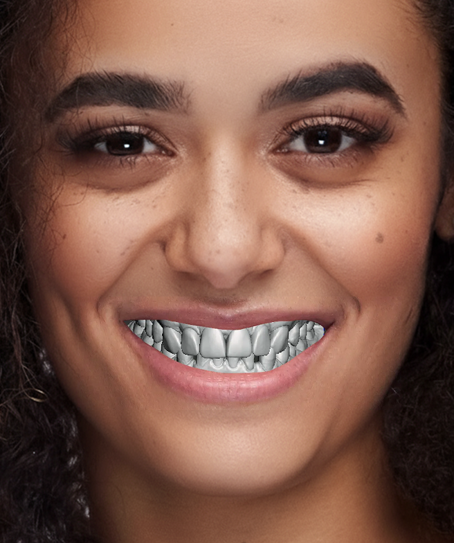 Smile Rendering — initial