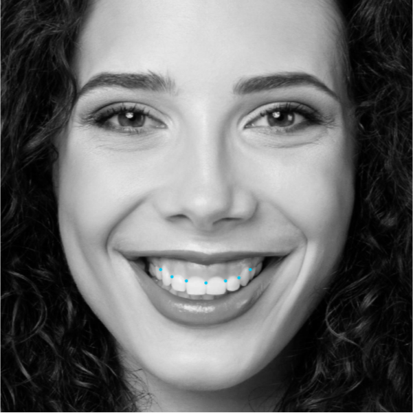 Dentscape